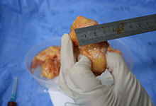 市面常见的丰体针有哪些牌子